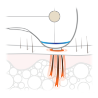 Rio LAHH Go Laser Image #10